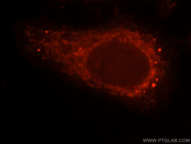 beta Arrestin 1 Antibody in Immunocytochemistry (ICC/IF)