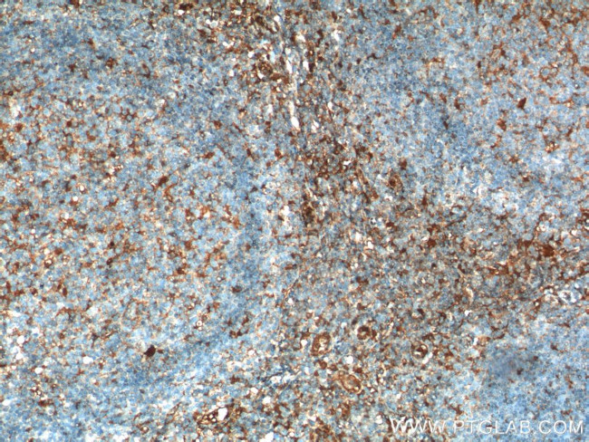 beta Arrestin 1 Antibody in Immunohistochemistry (Paraffin) (IHC (P))