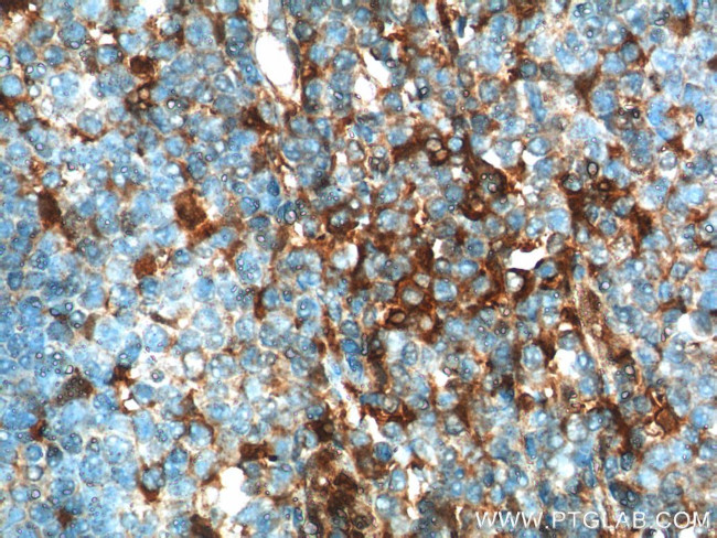 beta Arrestin 1 Antibody in Immunohistochemistry (Paraffin) (IHC (P))