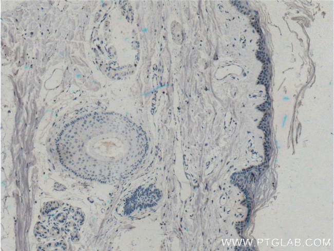 ST6GALNAC1 Antibody in Immunohistochemistry (Paraffin) (IHC (P))