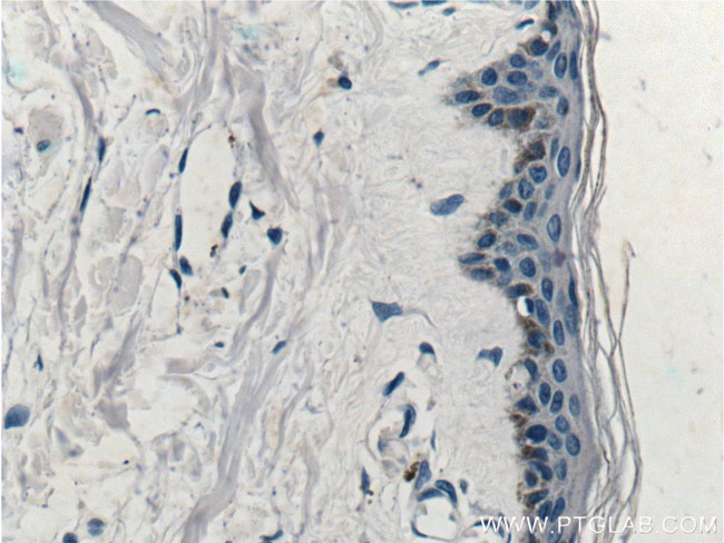 ST6GALNAC1 Antibody in Immunohistochemistry (Paraffin) (IHC (P))
