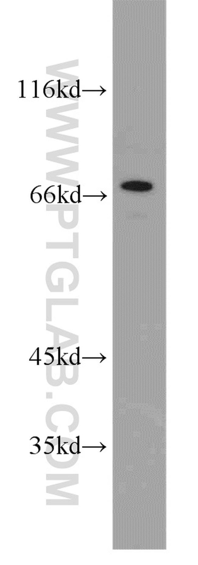 ST6GALNAC1 Antibody in Western Blot (WB)