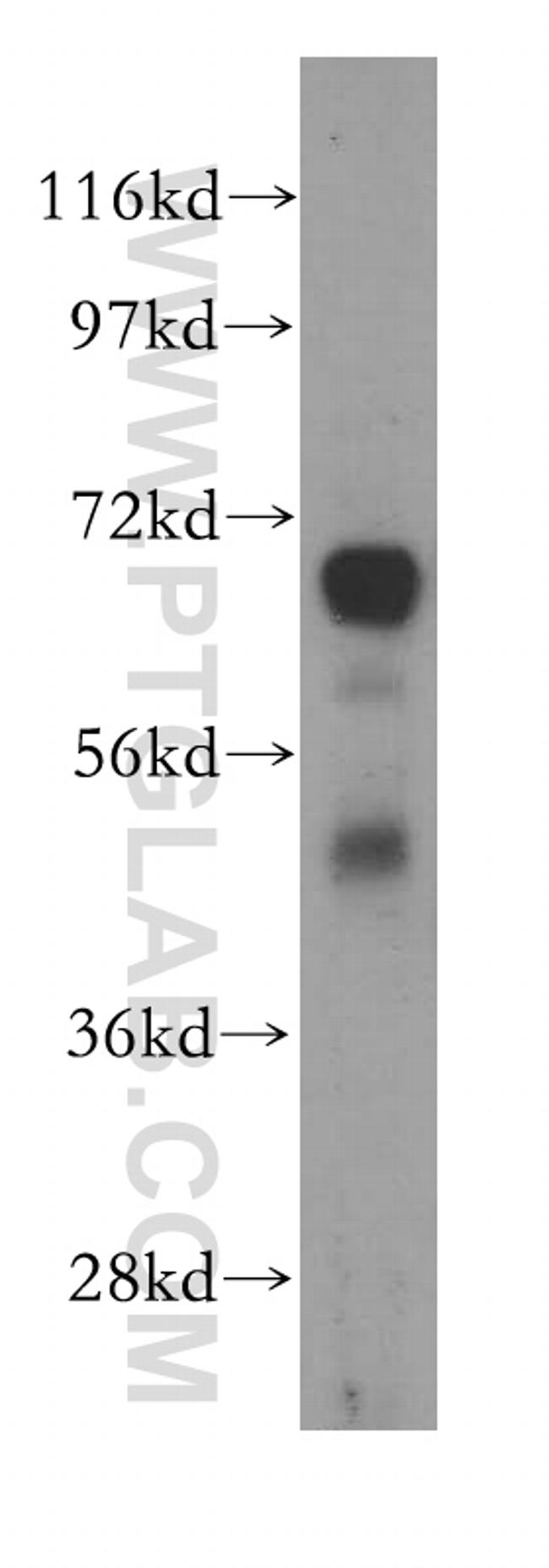 ST6GALNAC1 Antibody in Western Blot (WB)