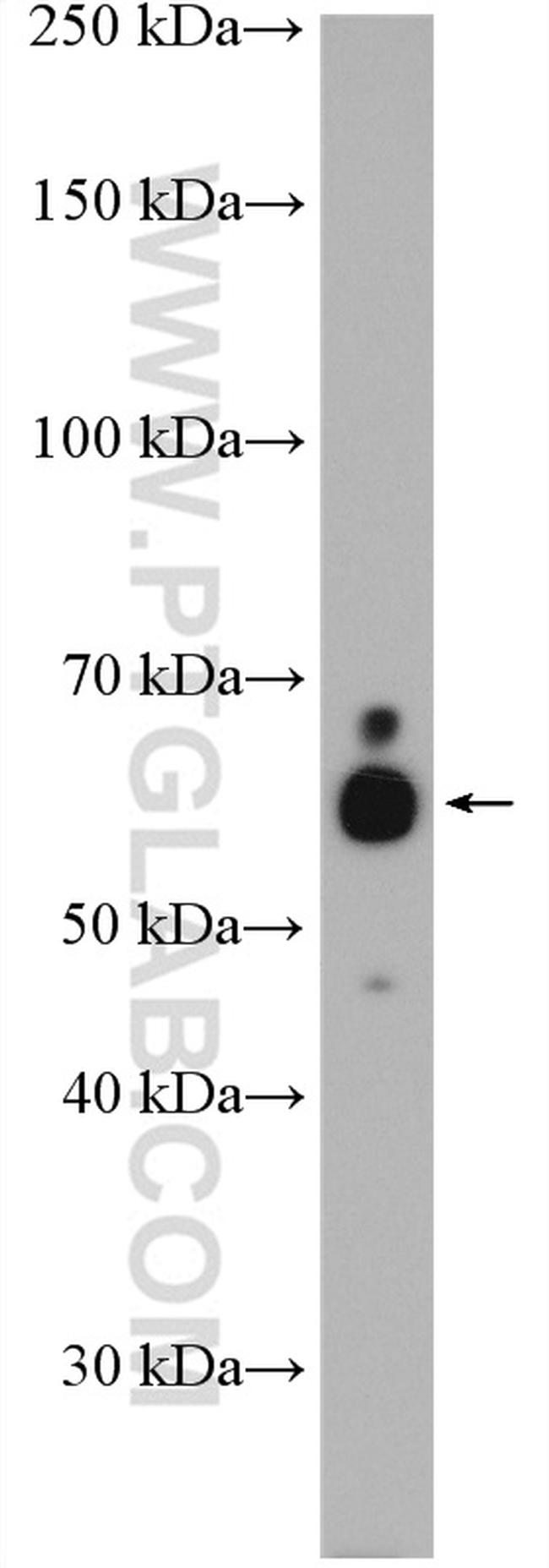 ST6GALNAC1 Antibody in Western Blot (WB)