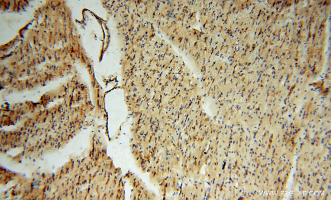 ICAM-1 Antibody in Immunohistochemistry (Paraffin) (IHC (P))