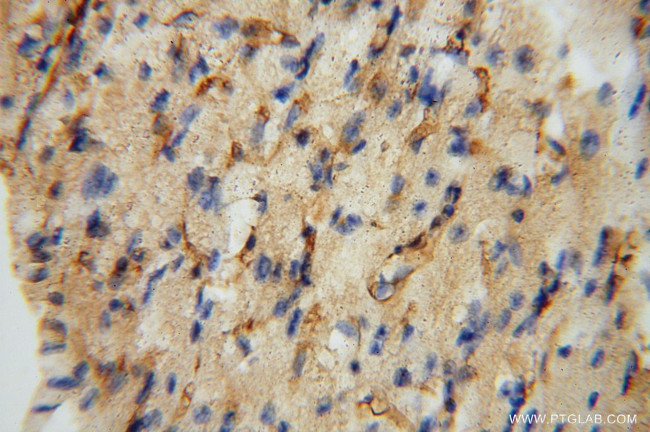 ICAM-1 Antibody in Immunohistochemistry (Paraffin) (IHC (P))