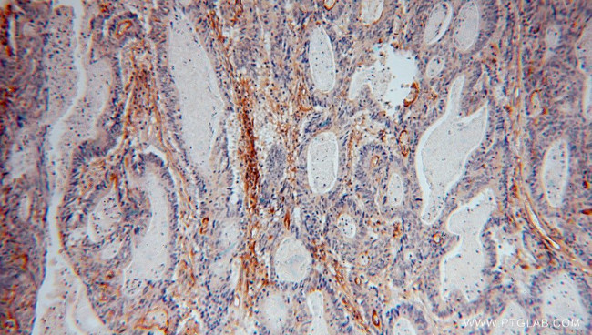 ICAM-1 Antibody in Immunohistochemistry (Paraffin) (IHC (P))