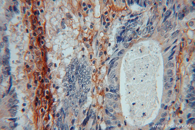 ICAM-1 Antibody in Immunohistochemistry (Paraffin) (IHC (P))