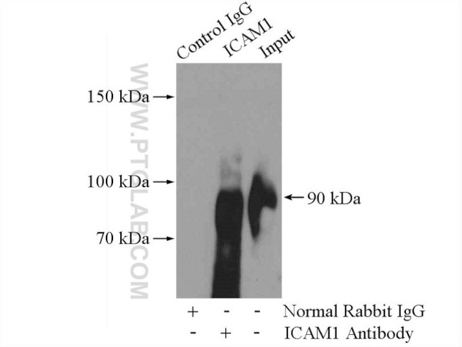 ICAM-1 Antibody in Immunoprecipitation (IP)