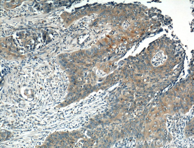 Interferon gamma Antibody in Immunohistochemistry (Paraffin) (IHC (P))