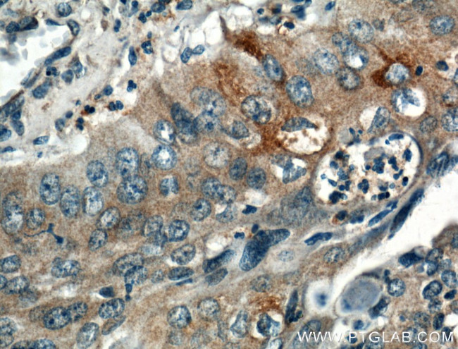 Interferon gamma Antibody in Immunohistochemistry (Paraffin) (IHC (P))