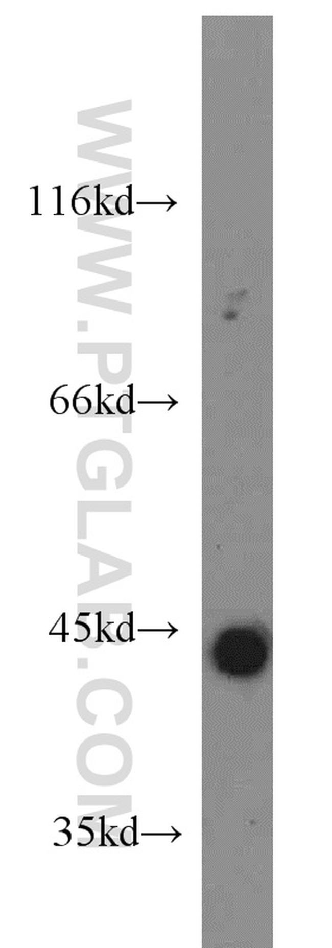 Interferon gamma Antibody in Western Blot (WB)