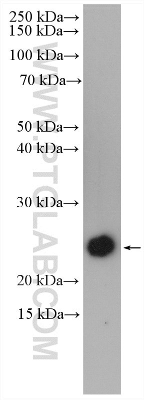 Interferon gamma Antibody in Western Blot (WB)