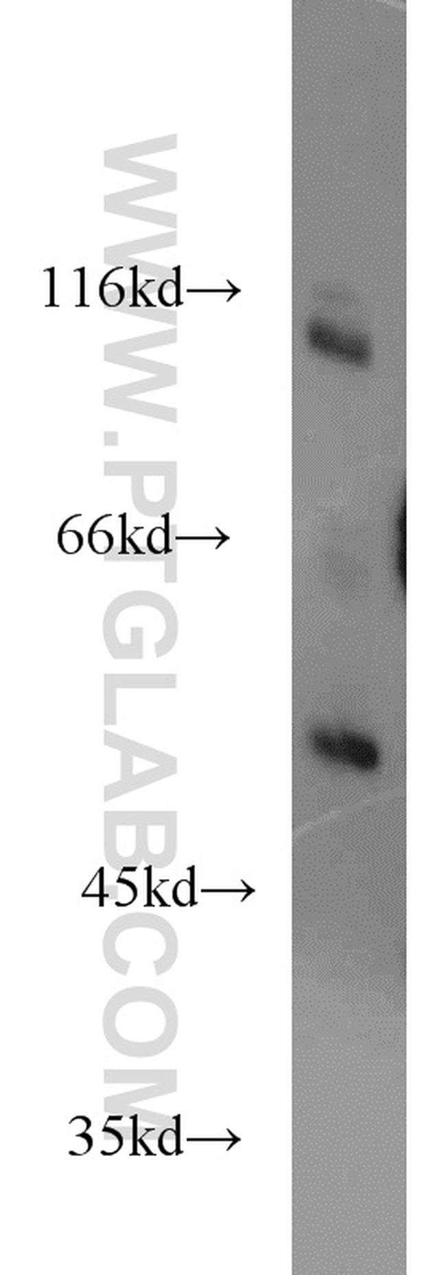 RIPK2 Antibody in Western Blot (WB)