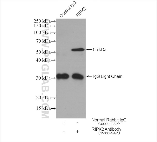 RIPK2 Antibody in Immunoprecipitation (IP)