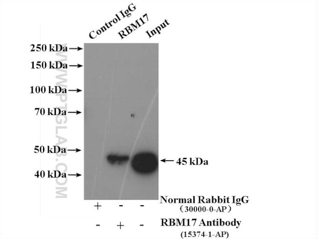 RBM17 Antibody in Immunoprecipitation (IP)