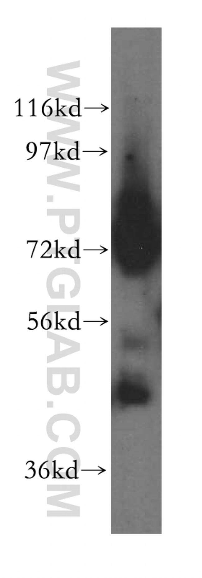 RBM17 Antibody in Western Blot (WB)