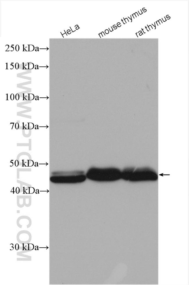 RBM17 Antibody in Western Blot (WB)