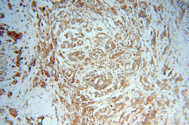 SPTLC1 Antibody in Immunohistochemistry (Paraffin) (IHC (P))