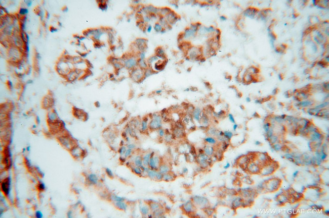 SPTLC1 Antibody in Immunohistochemistry (Paraffin) (IHC (P))