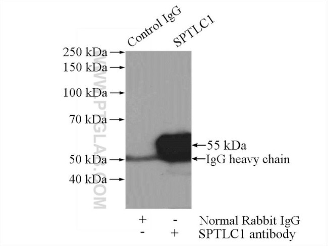 SPTLC1 Antibody in Immunoprecipitation (IP)