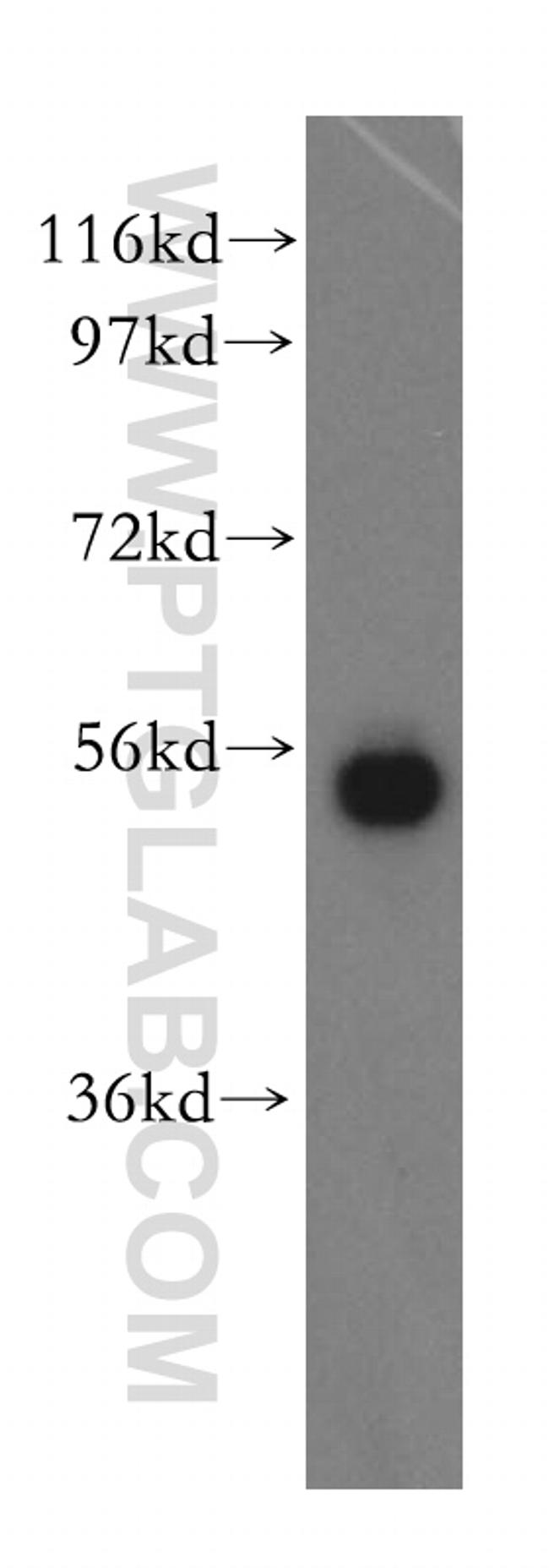 SPTLC1 Antibody in Western Blot (WB)