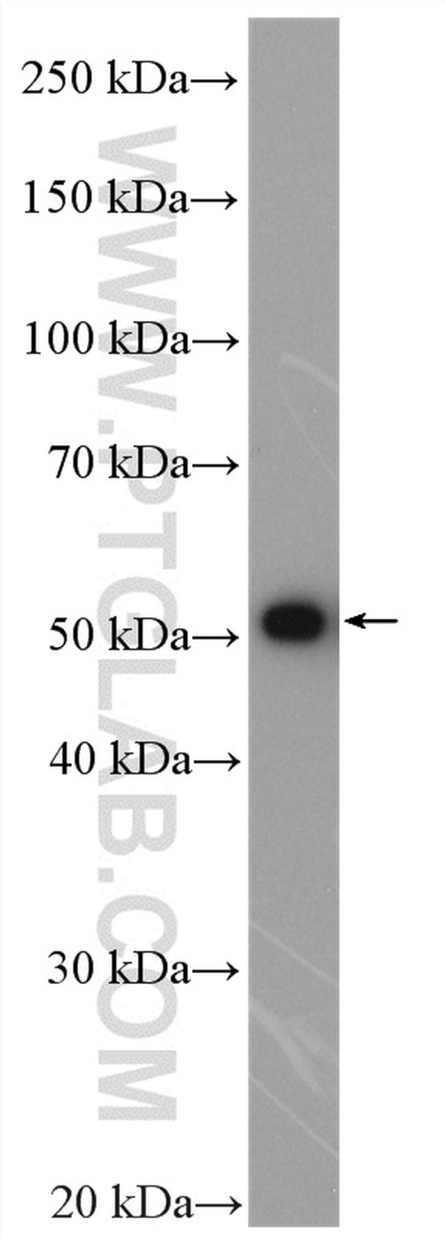 SPTLC1 Antibody in Western Blot (WB)