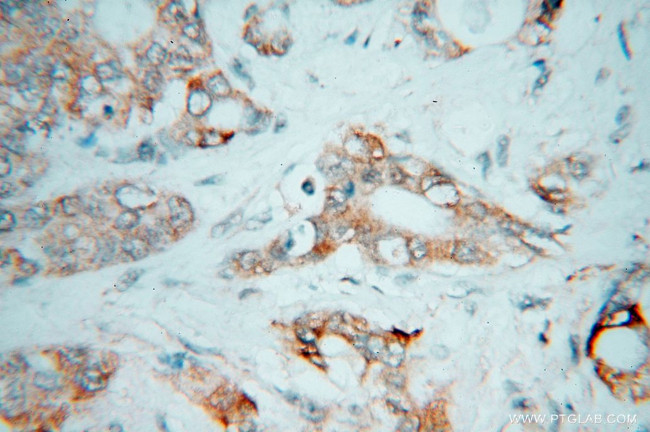 CES2 Antibody in Immunohistochemistry (Paraffin) (IHC (P))