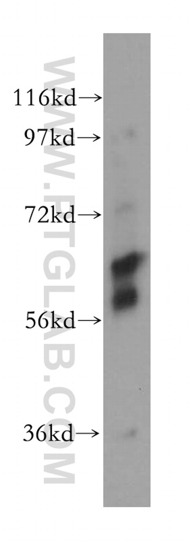 CES2 Antibody in Western Blot (WB)