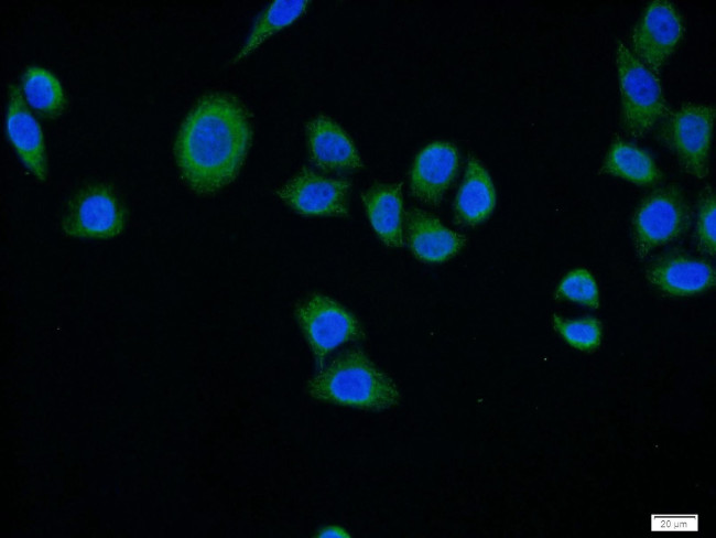 SURF1 Antibody in Immunocytochemistry (ICC/IF)