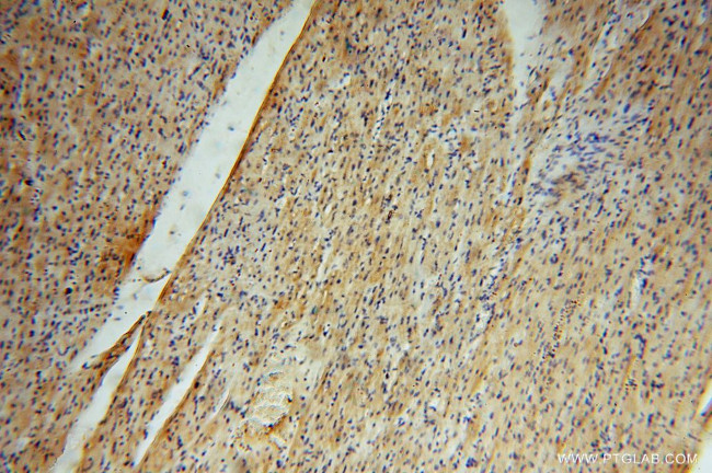 SURF1 Antibody in Immunohistochemistry (Paraffin) (IHC (P))