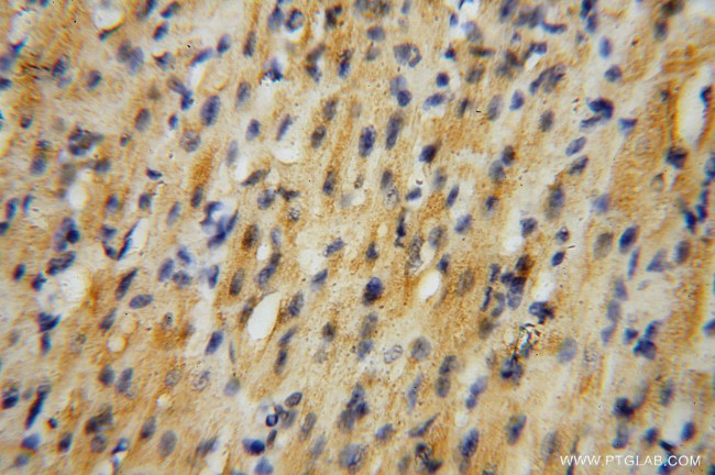 SURF1 Antibody in Immunohistochemistry (Paraffin) (IHC (P))