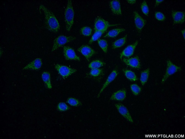 CEL Antibody in Immunocytochemistry (ICC/IF)