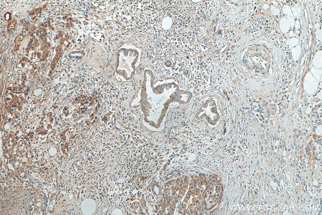 CEL Antibody in Immunohistochemistry (Paraffin) (IHC (P))