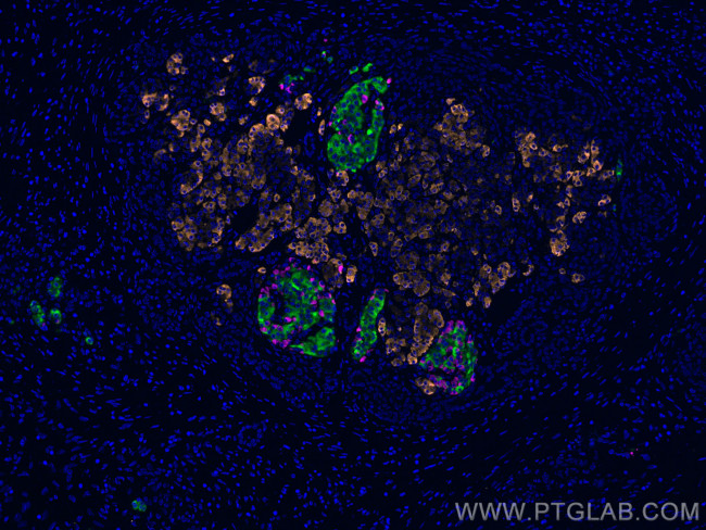 CEL Antibody in Immunohistochemistry (PFA fixed) (IHC (PFA))