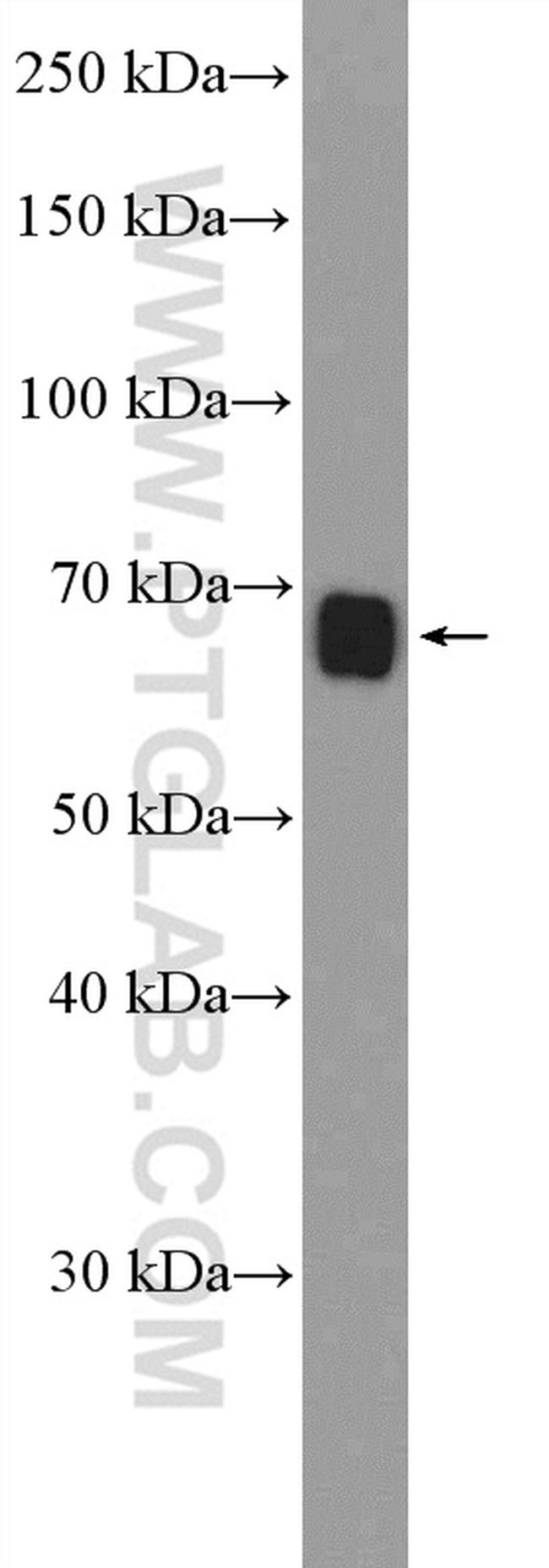 CEL Antibody in Western Blot (WB)