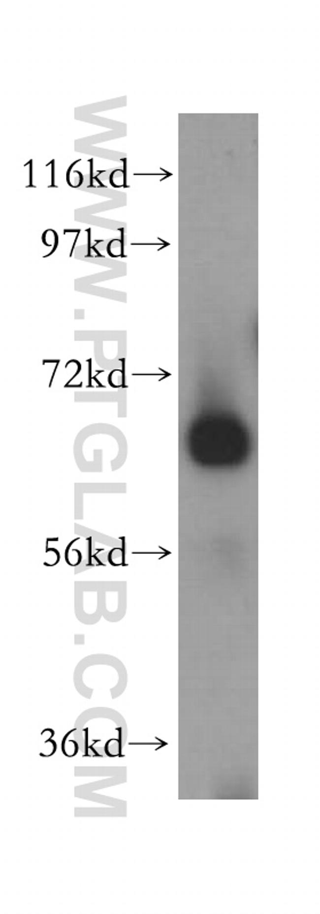 CEL Antibody in Western Blot (WB)