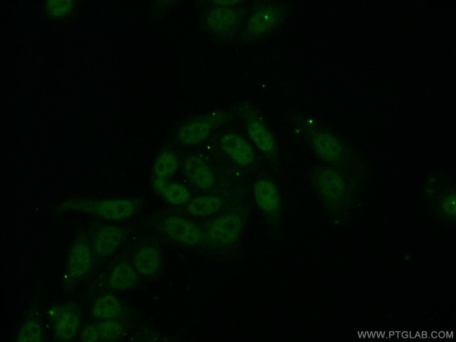 RPL6 Antibody in Immunocytochemistry (ICC/IF)