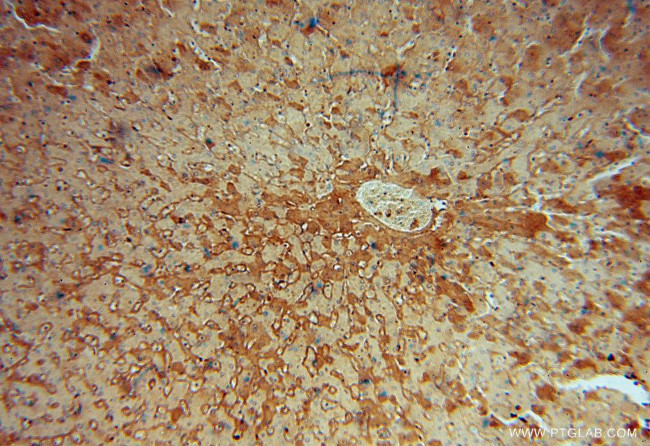 RPL6 Antibody in Immunohistochemistry (Paraffin) (IHC (P))