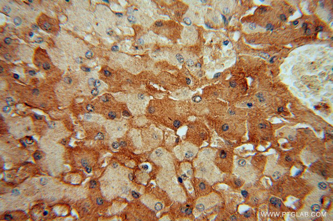 RPL6 Antibody in Immunohistochemistry (Paraffin) (IHC (P))