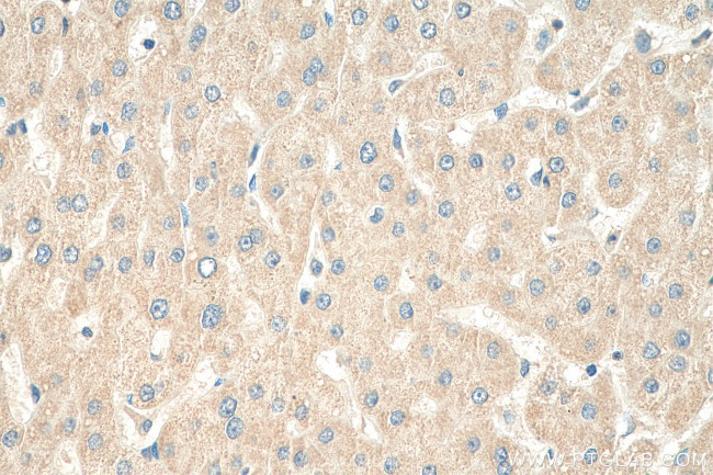 RPL6 Antibody in Immunohistochemistry (Paraffin) (IHC (P))