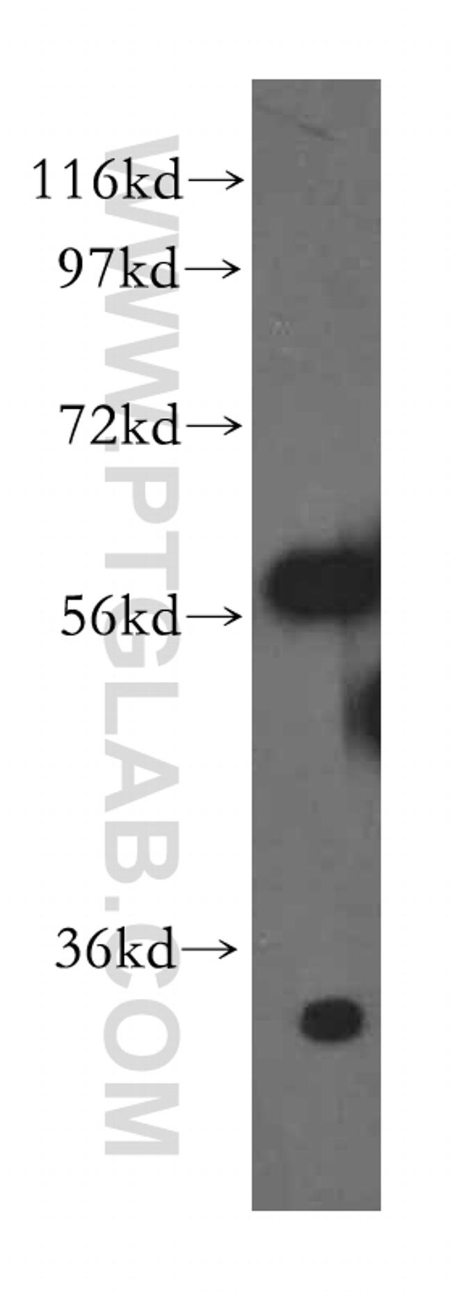 RPL6 Antibody in Western Blot (WB)