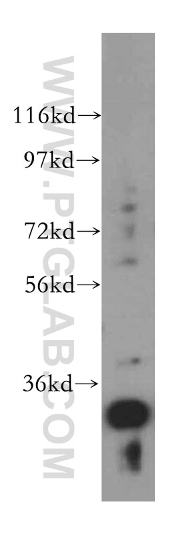 RPL6 Antibody in Western Blot (WB)