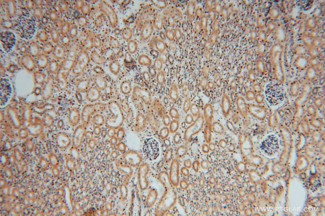 GNB3 Antibody in Immunohistochemistry (Paraffin) (IHC (P))