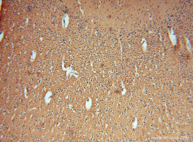 GNB3 Antibody in Immunohistochemistry (Paraffin) (IHC (P))