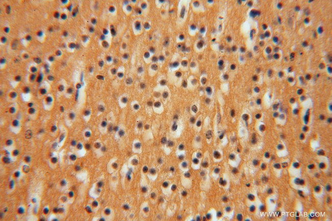 GNB3 Antibody in Immunohistochemistry (Paraffin) (IHC (P))