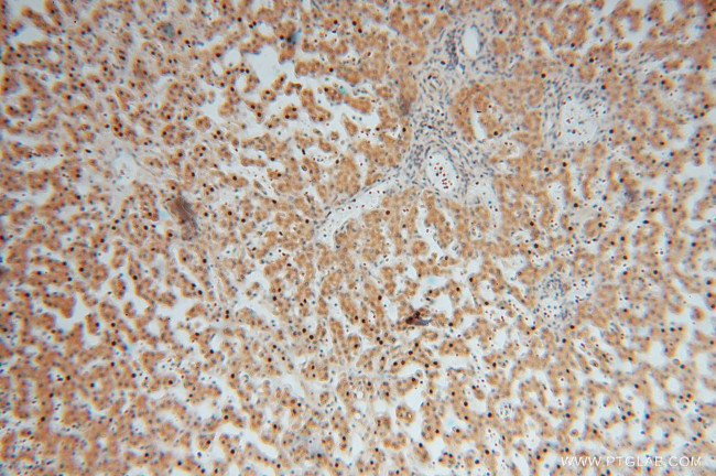 GNB3 Antibody in Immunohistochemistry (Paraffin) (IHC (P))