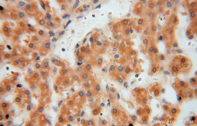 GNB3 Antibody in Immunohistochemistry (Paraffin) (IHC (P))