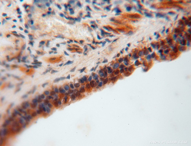 GNB3 Antibody in Immunohistochemistry (Paraffin) (IHC (P))