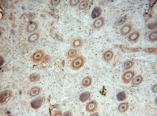 GNB3 Antibody in Immunohistochemistry (Paraffin) (IHC (P))